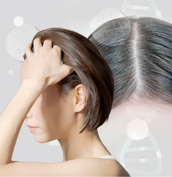 iPSF頭皮投与プログラム（頭皮注入）