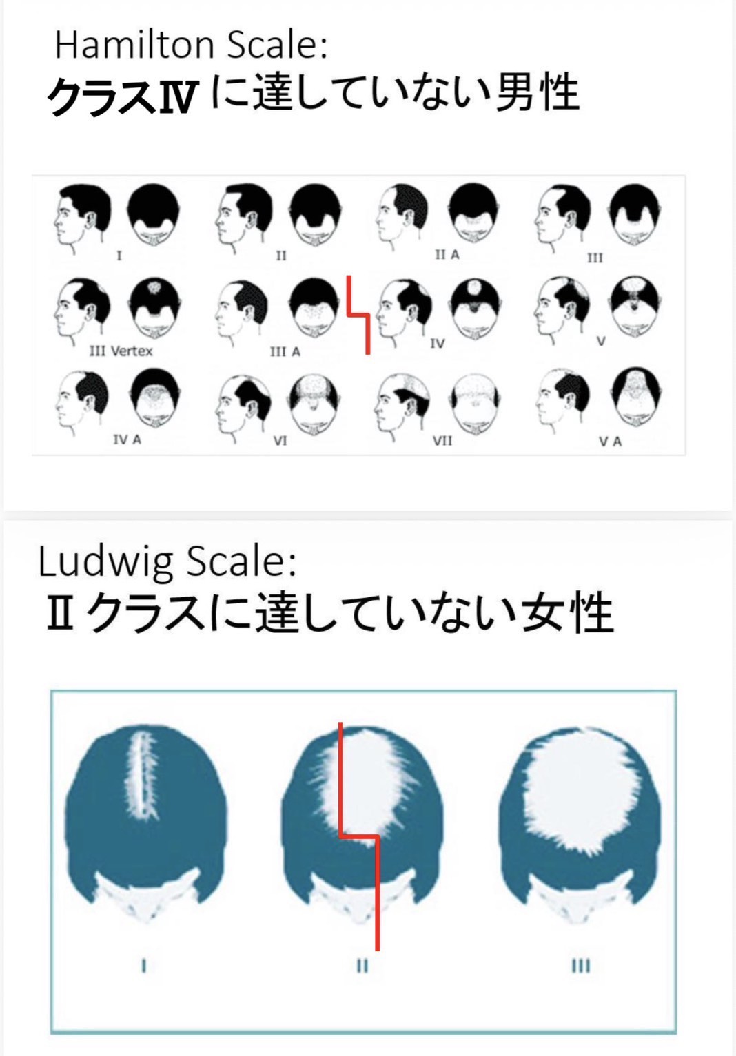 実例