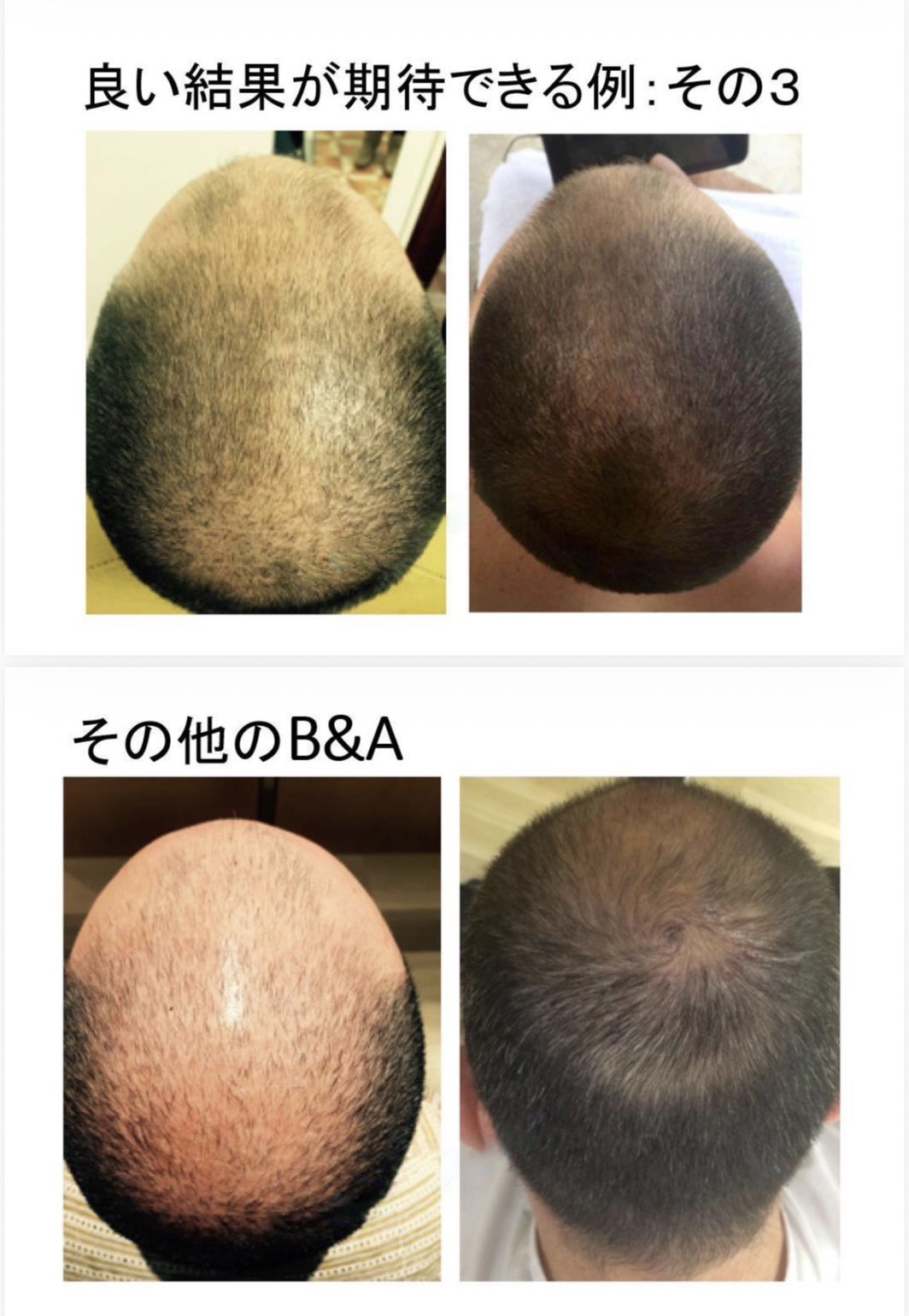実例