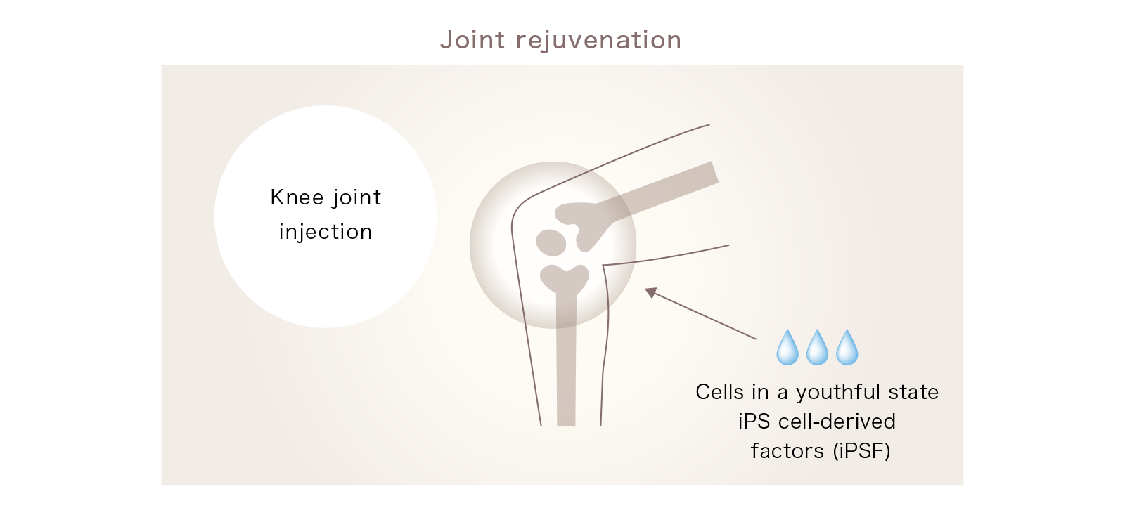 Joint Rejuvenation